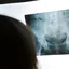 Onderzoeker Universiteit Twente analyseert heupfractuur op röntgenfoto met AI-ondersteuning